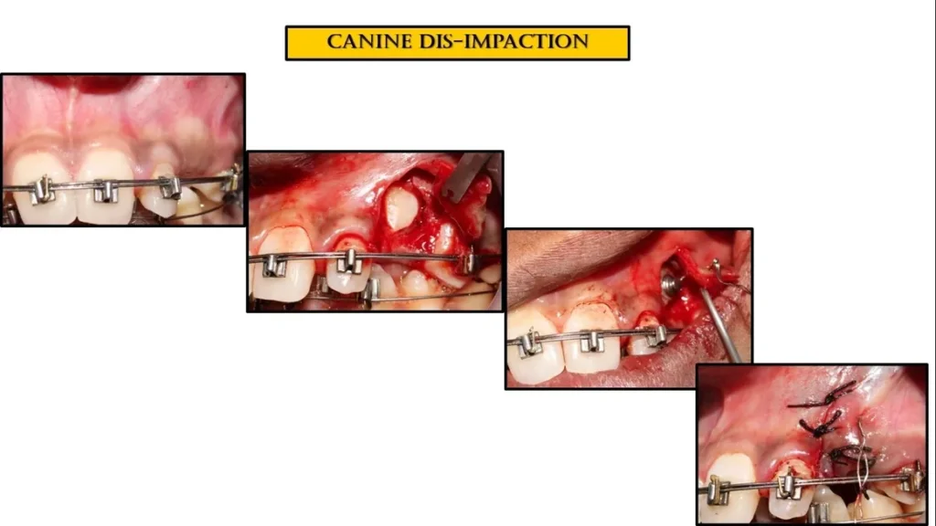 rs=w_1160,h_652 (11)